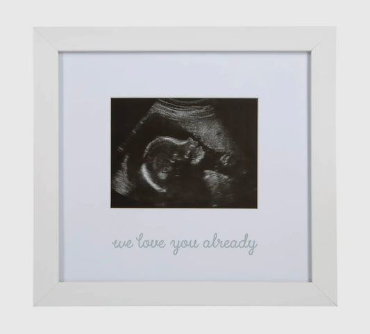 Sonogram Frame